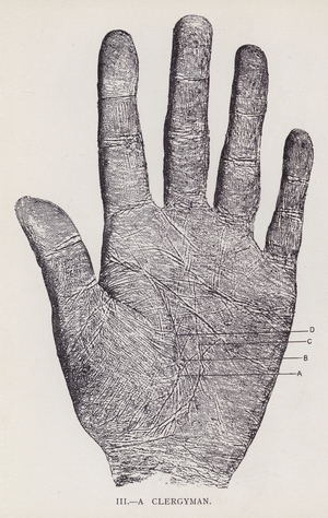 A Clergyman (litho)