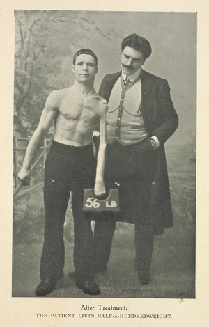After treatment. The patient lifts half-a-hundredweight.