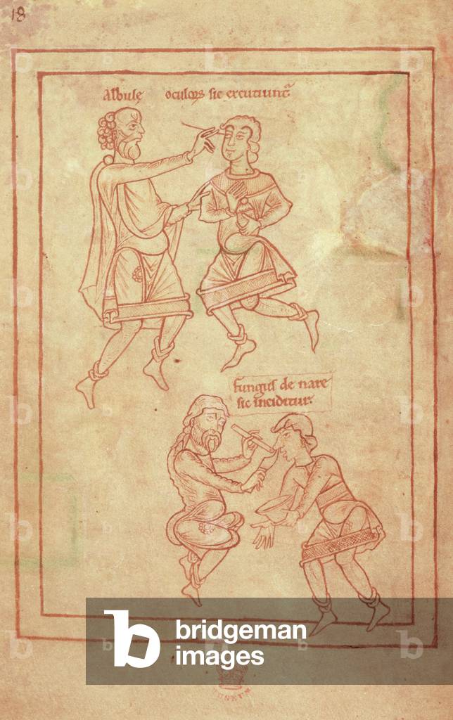 Harl 1585 f.9v Medici che eseguono operazioni di occhio e naso da un trattato medico in latino, XII secolo