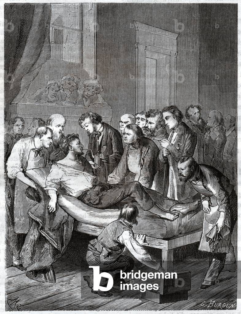 First surgical operation with sulfuric ether anesthesia at Boston Hospital by William Morton, 19th century (engraving)