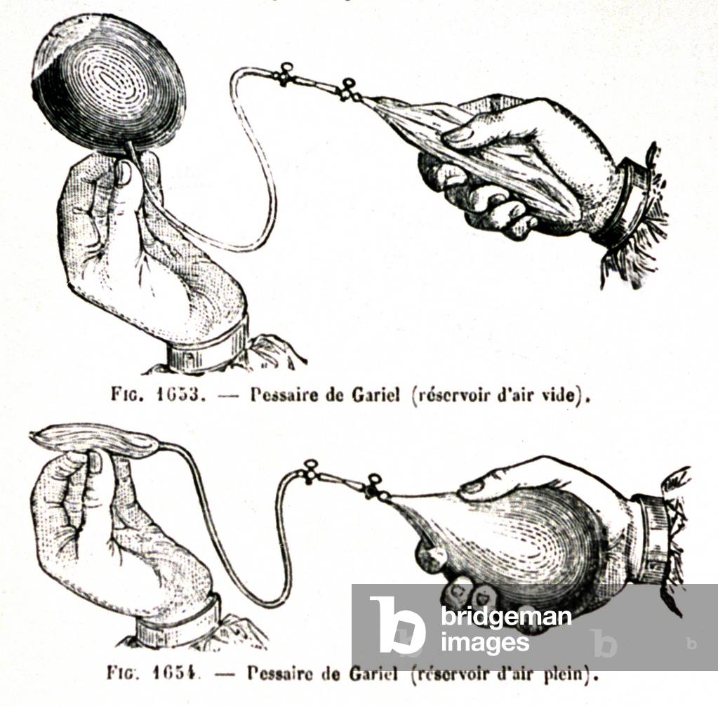 Pessary by Gariel, c.1850 (engraving)