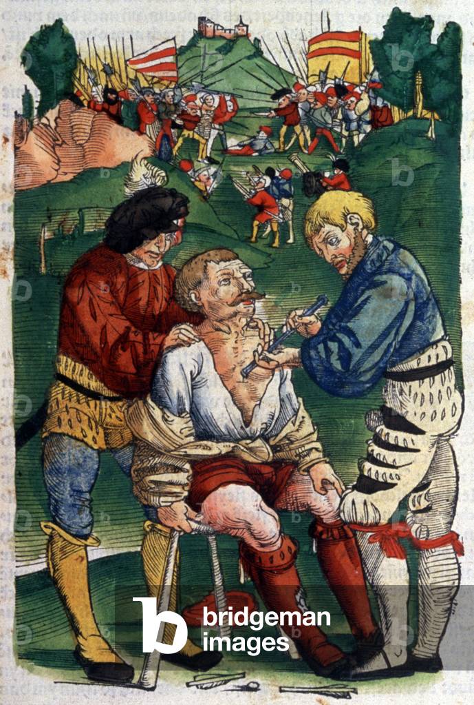 Extraction of an arrow point on a battle field, 1540 (engraving)