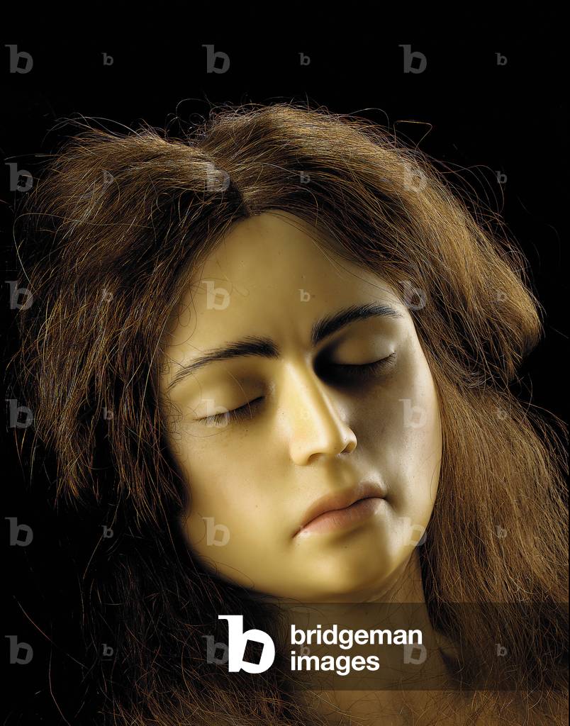 Anatomical model of an ovarian pregnancy, detail (wax) (see also 1126545-6)