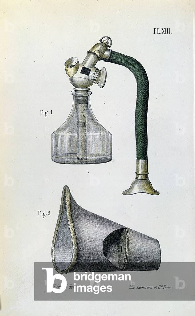 Mask for administering ether to anaesthetize a patient, from a medical manual by Jean-Baptiste-Leon Dubreuil (colour litho)