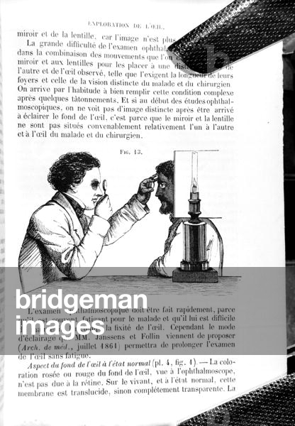 Illustration from 'Traite Pratique des Maladies des Yeux', a translation of 'A Manual on the Principles and Practice of Ophthalmic Medicine and Surgery', Thomas Wharton Jones (1808-91) by E. Foucher, published Paris 1862 (engraving) (b/w photo)