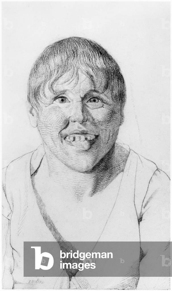 Cretin, vista frontale, illustrazione da un trattato inedito di Jean Etienne Dominique Esquirol (1772-1840) su