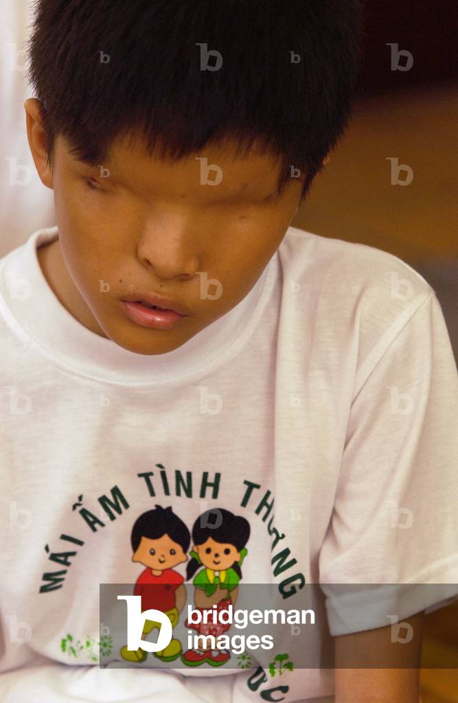 Vietnam Agent Orange (photo)