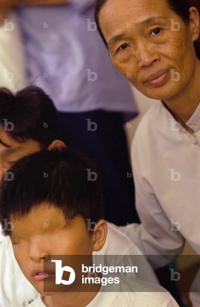 Vietnam Agent Orange (photo)