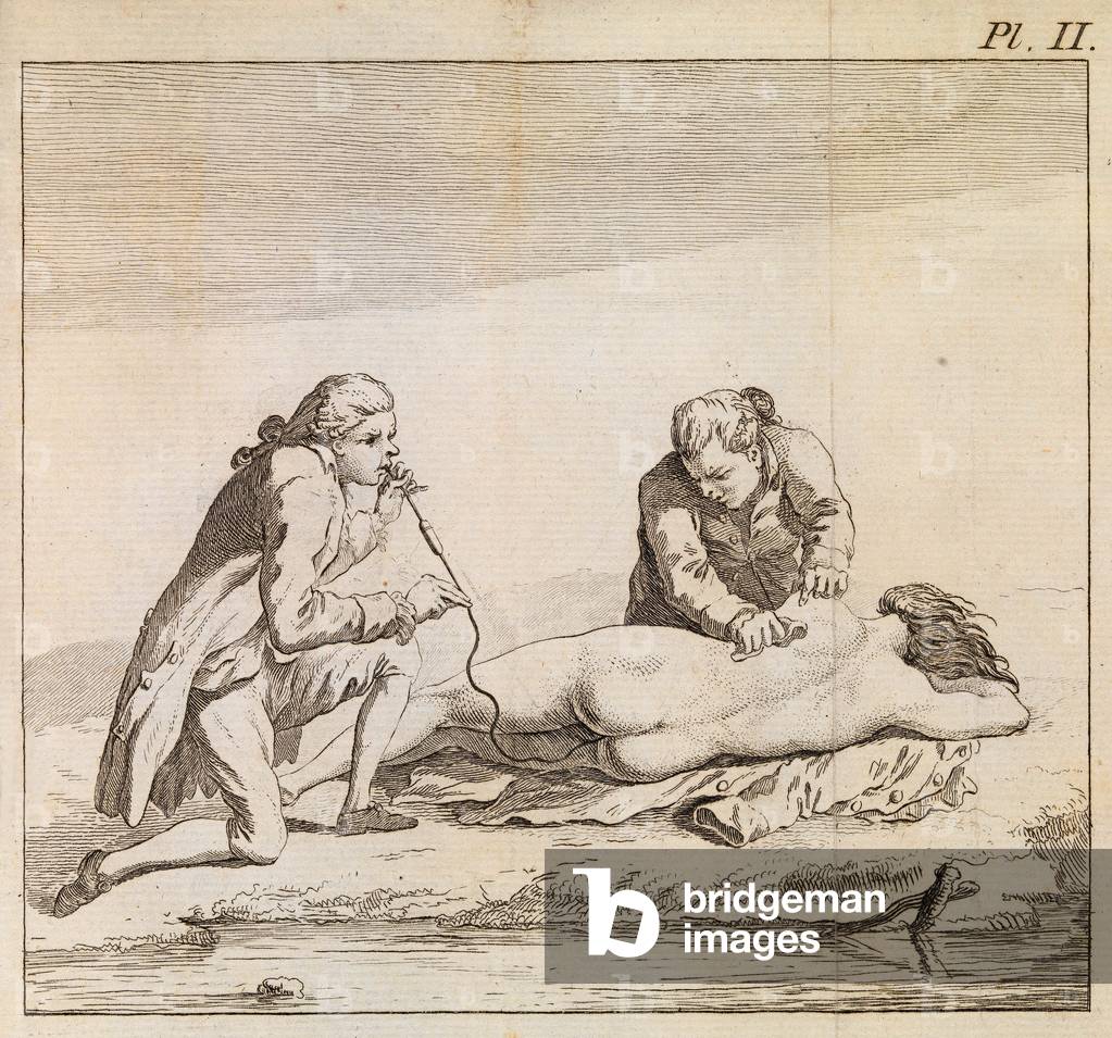 Using a fumigator to blow tobacco smoke into the bowels of drowned woman to aid resuscitation, c.1790 (engraving)
