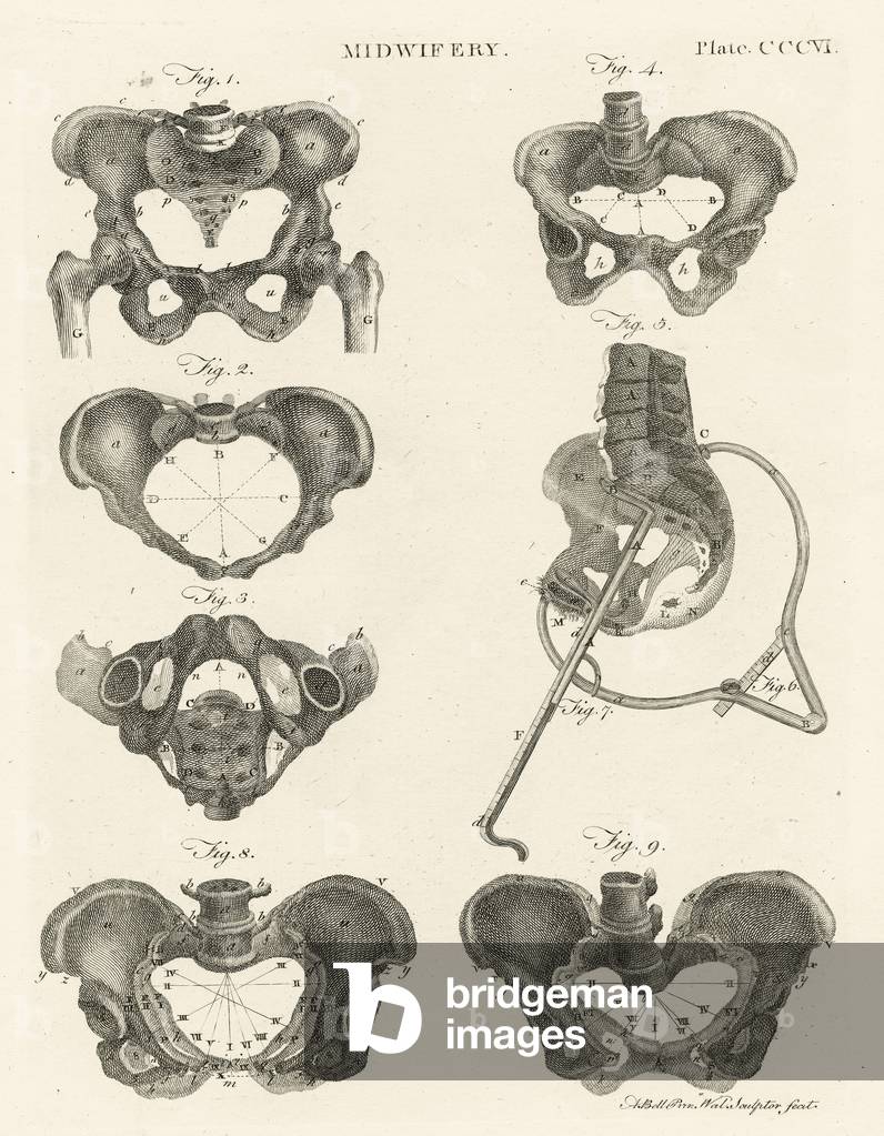 Midwifery, illustration from 'Encyclopedia Britannica', published in Edinburgh, 1798 (copperplate engraving)