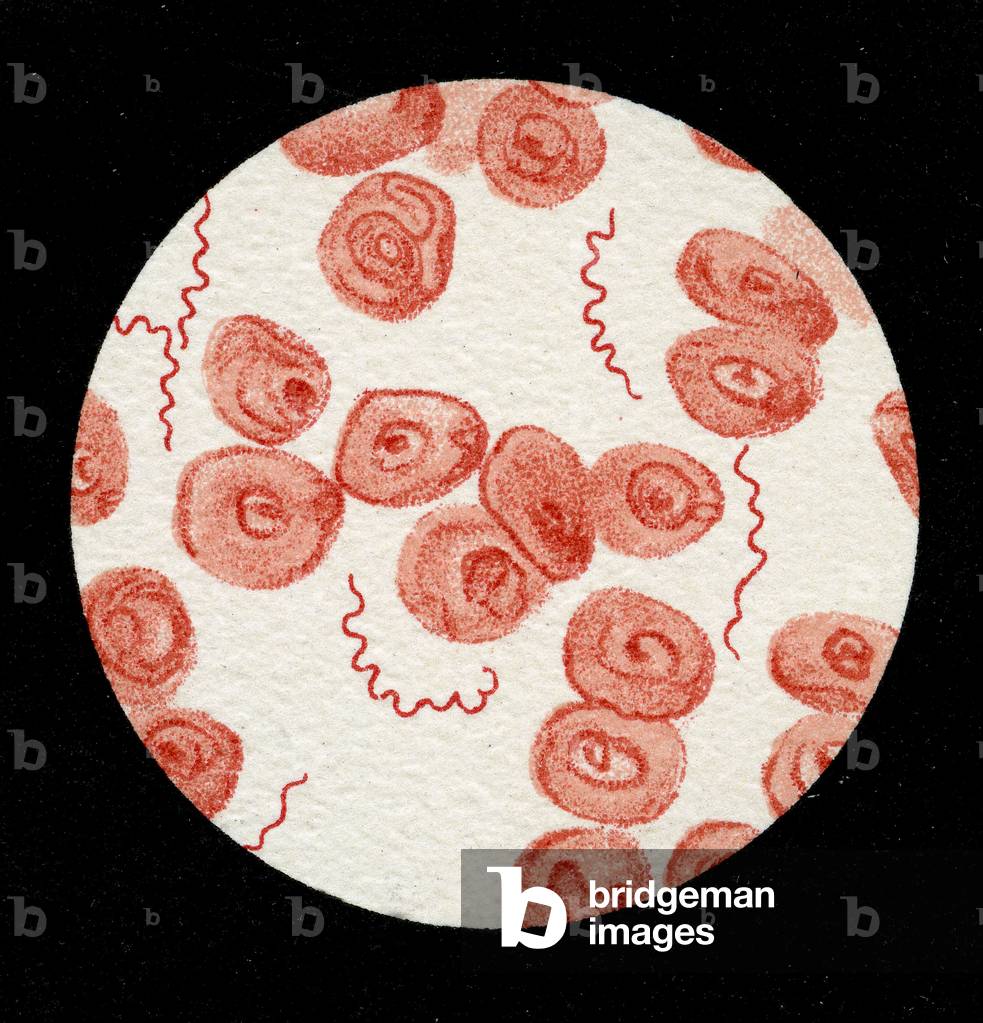 Spirillum of the Lyme disease causing bacteria, Spirochaetes Borrelia Recurrentis, in blood sample, 1906 (litho)
