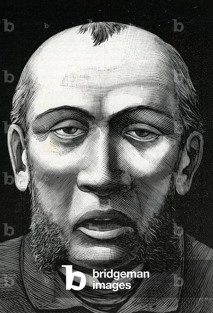 Patient with cerebral softening (engraving) 1888