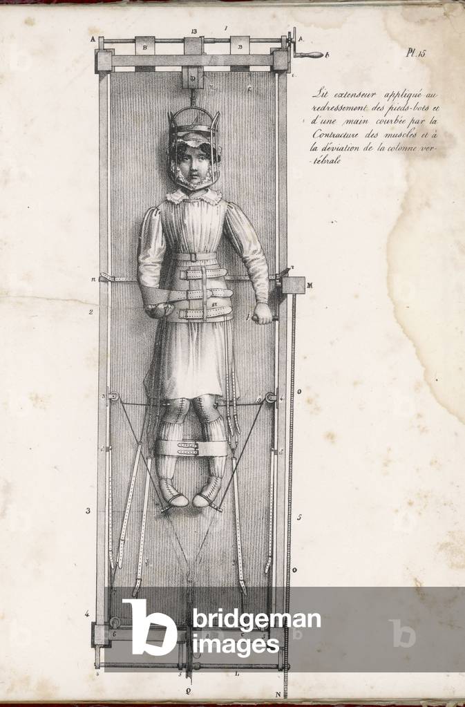 Immagine di Stampa "TRATTAMENTO DELLE GAMBE AD ARCO" 1827