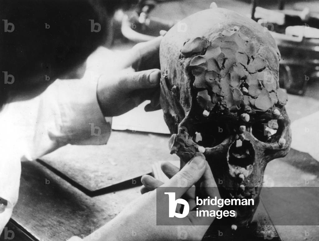Image of Photography depicting SKULL RECONSTRUCTION 1930 by Barnaby's Studios Ltd