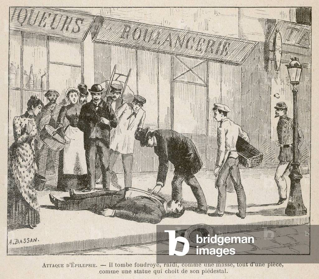 CRISE D'ÉPILEPSIE