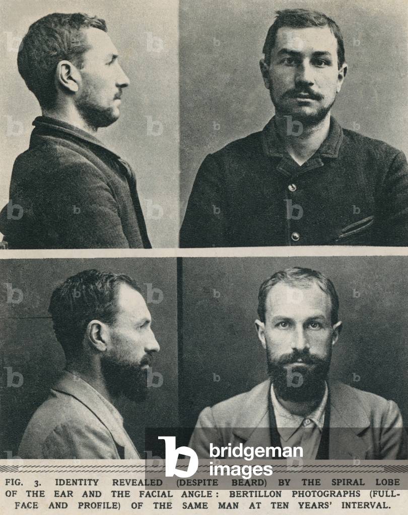 Bertillon system photographs taken at a ten year's interval, reveal it is the same man by the spiral lobe of the ear and the facial angle