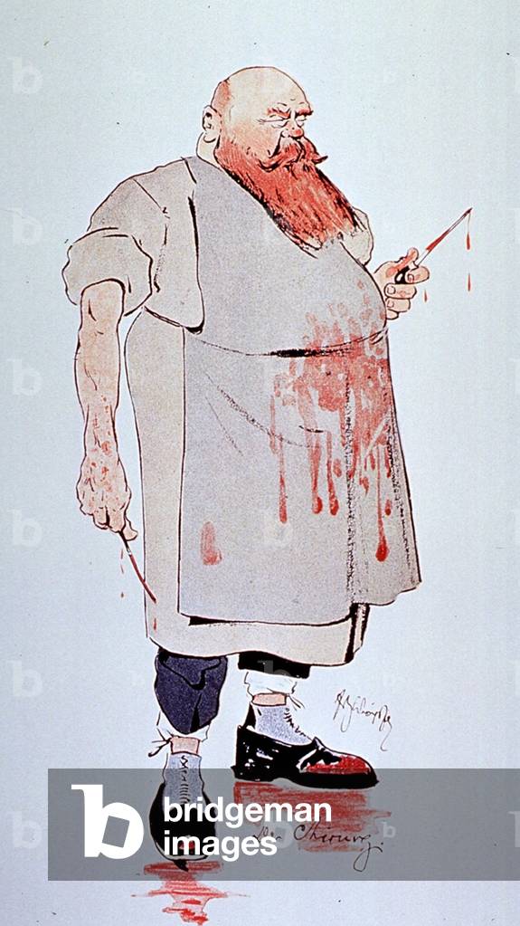 Caricature of a surgeon holding instruments and wearing blood splattered apron and shoes. In the second half of the 19th century anesthesia allowed more invasive and frightening surgeries. 1906 by Fritz Schonpflug