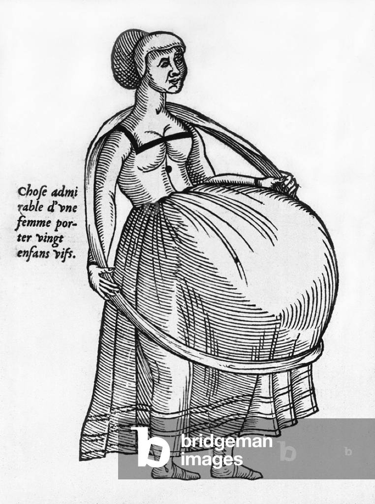 Pregnant woman using a hoop to support burgeoning womb. Illustration from a medical text by Ambrose Pare, the great French surgeon, 1575