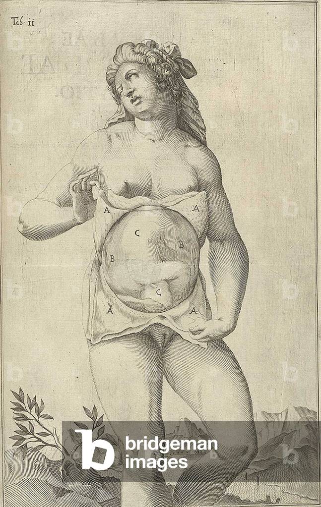 Development of the fetus. Female figure with womb exposed displaying a fetus from Adriaan van de Spiegel's, DE FORMATO FOETU LIBER EXORNATUS, 1626. Engraving by Francesco Valesio (b. c. 1560), after drawing by Odoardo Fialetti (1573-1638)