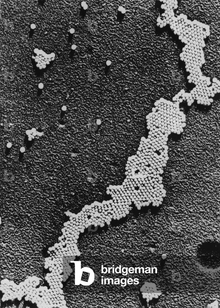 Polio (Poliomyelitis) virus, the cause of Infantile Paralysis, was discovered in 1908 by Karl Landsteiner. The vaccine for polio was developed between 1948 and 1953, when the researchers were able to grow large amounts of the virus, and Jonas Salk developed a safe killed-virus vaccine