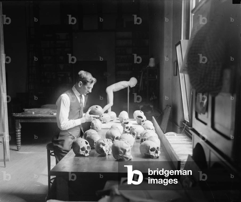 William H. Egberts (1868- 1959) at the Smithsonian's Anthropological Laboratory in 1926. He examines skulls with marks from a surgical procedure, trepanation, that was practiced by Native Americans. About 90% of the trepanations showed evidence of healing, indicating the subjects survived the procedure