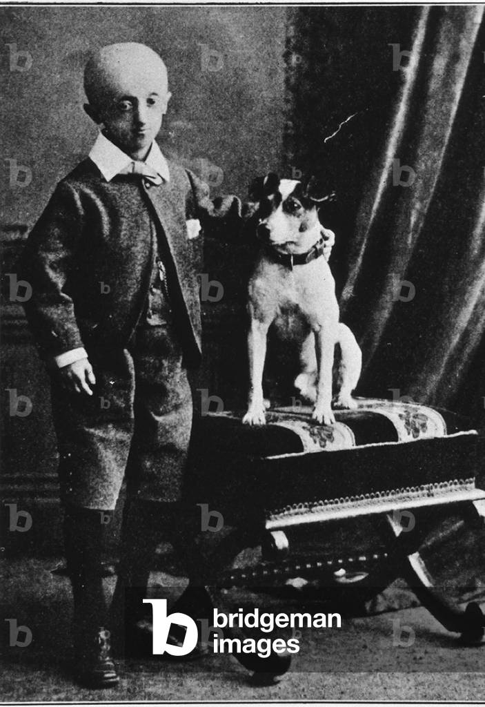 15 year old boy with Progeria, a rare children's disease that accelerates the rate of aging. The 15 year old posed with his dog in 1911