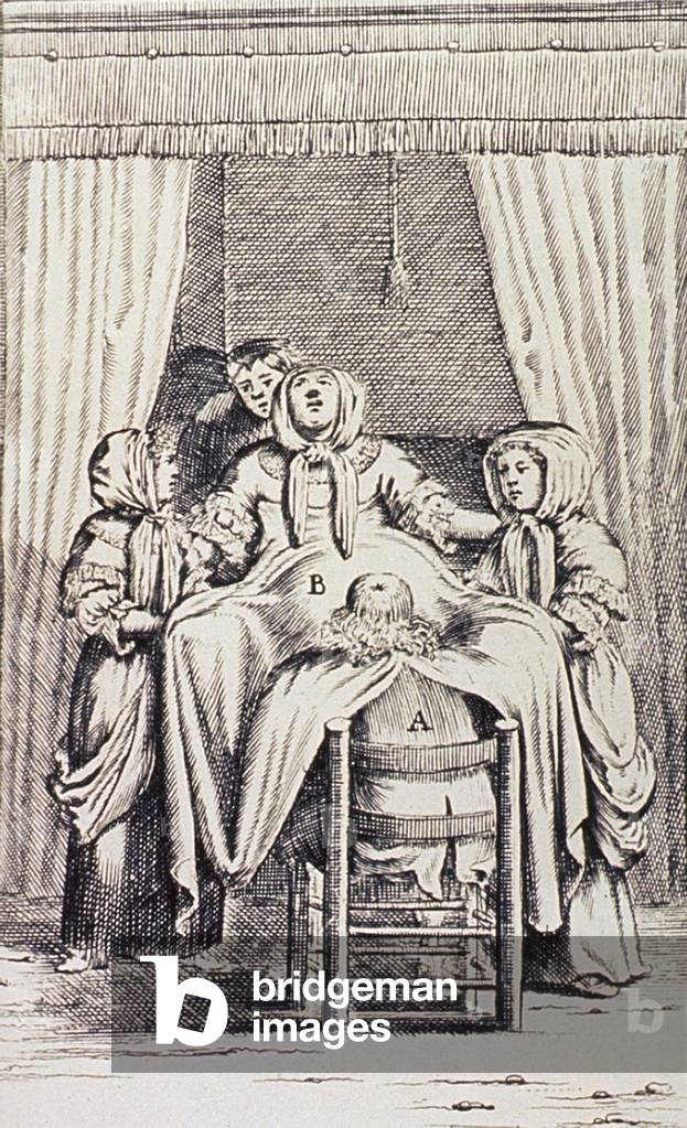 Woman in Labor. 1707 Dutch print of a woman assisted in childbirth by a male midwife, two young women, and another person, possibly her husband