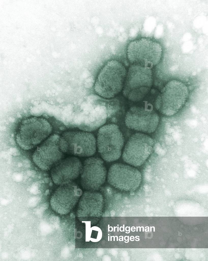 Smallpox viruses. A colorized transmission electron micrograph. 1975