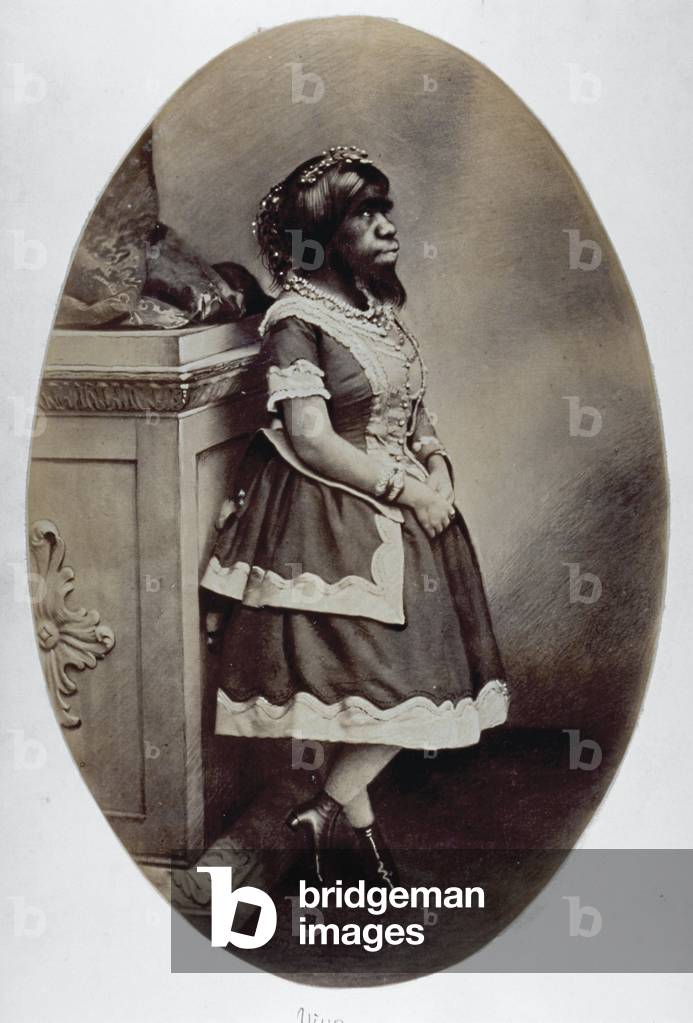 Full-length portrait of the human phenomenon Giulia Pastrana