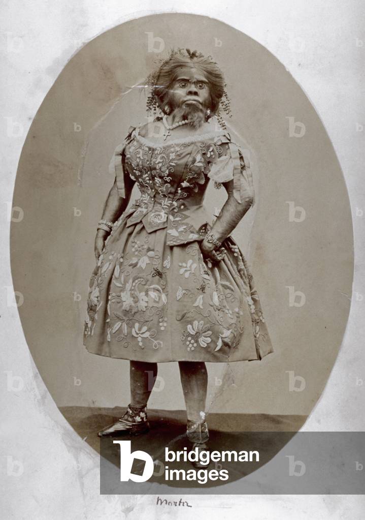 Post mortem portrait of Giulia Pastrana. The celebrated human phenomenon was embalmed by her husband after her death in 1860