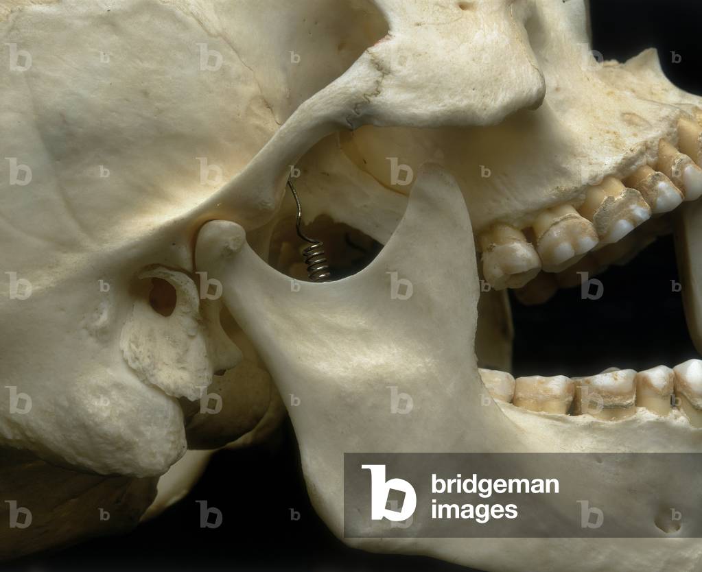 Adult cranium. Lateral view. Detail of the temporal-mandibular articulation. Anatomical exhibit housed at the Università degli Studi di Firenze, Department of Anatomy, Histology, Legal Medicine, Anatomy Section