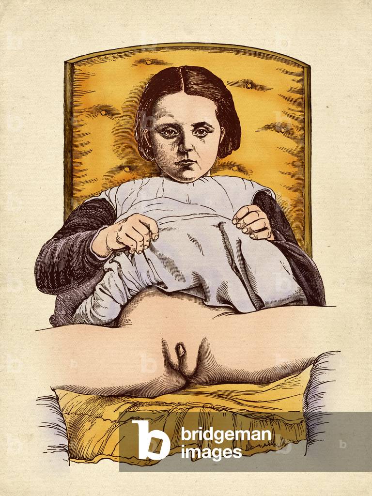 Hemaphrodites 