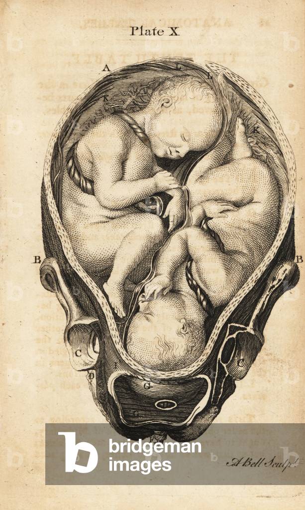 Front view of twins in utero at the start of labour. Copperplate engraving by Andrew Bell after an illustration by Jan van Rymsdyk from William Smellie's A Set of Anatomical Tables, Charles Elliot, Edinburgh, 1780.