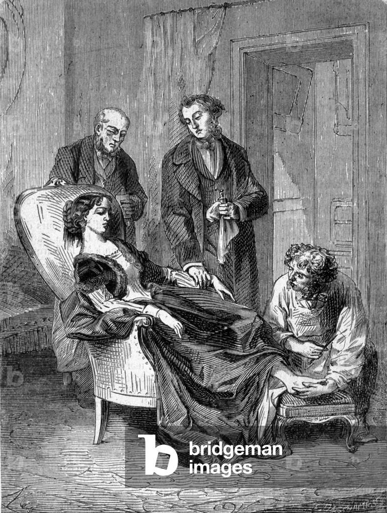 Deces of the girl Hannah Greener at the age of fifteen following one of the first chlorophorm anesthesies on 28/01/1848. Engraving from 1869.