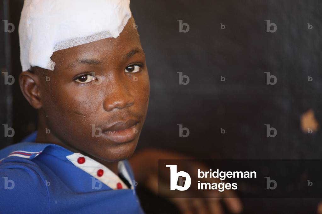 Young patient in an African hospital, Lome, Togo