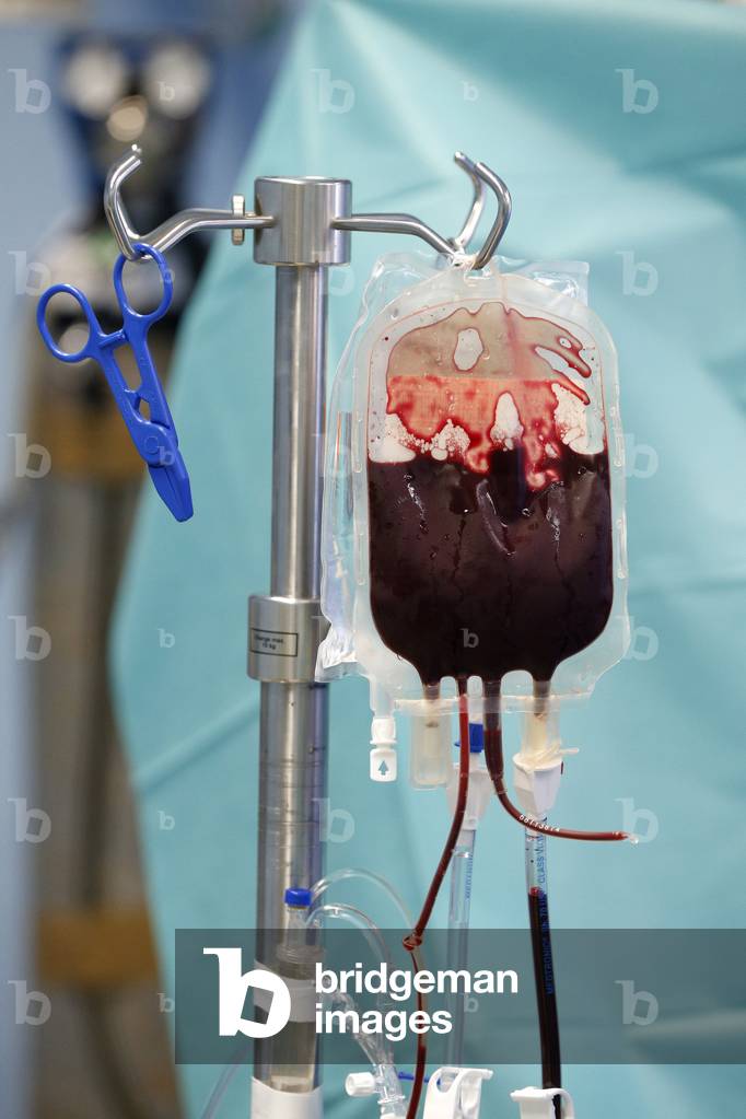 Brazzaville Hospital Operating theater Blood bag Blood transfusion, Brazzaville, Congo-Brazzaville