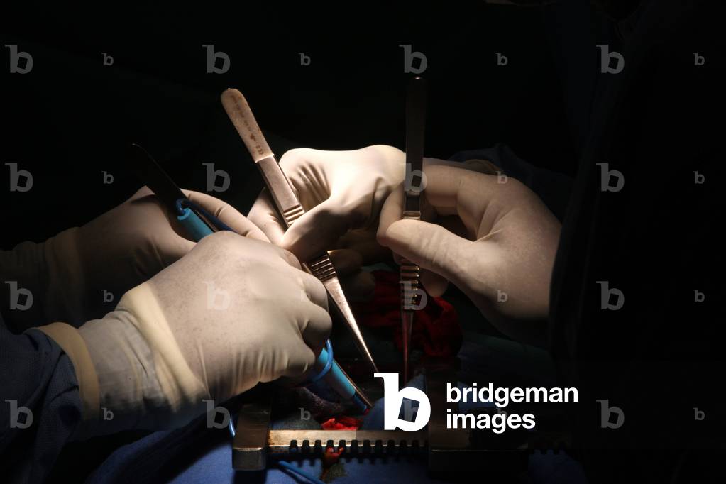 Operating theatre In a cardiac surgery ward in Africa. Dakar Senegal