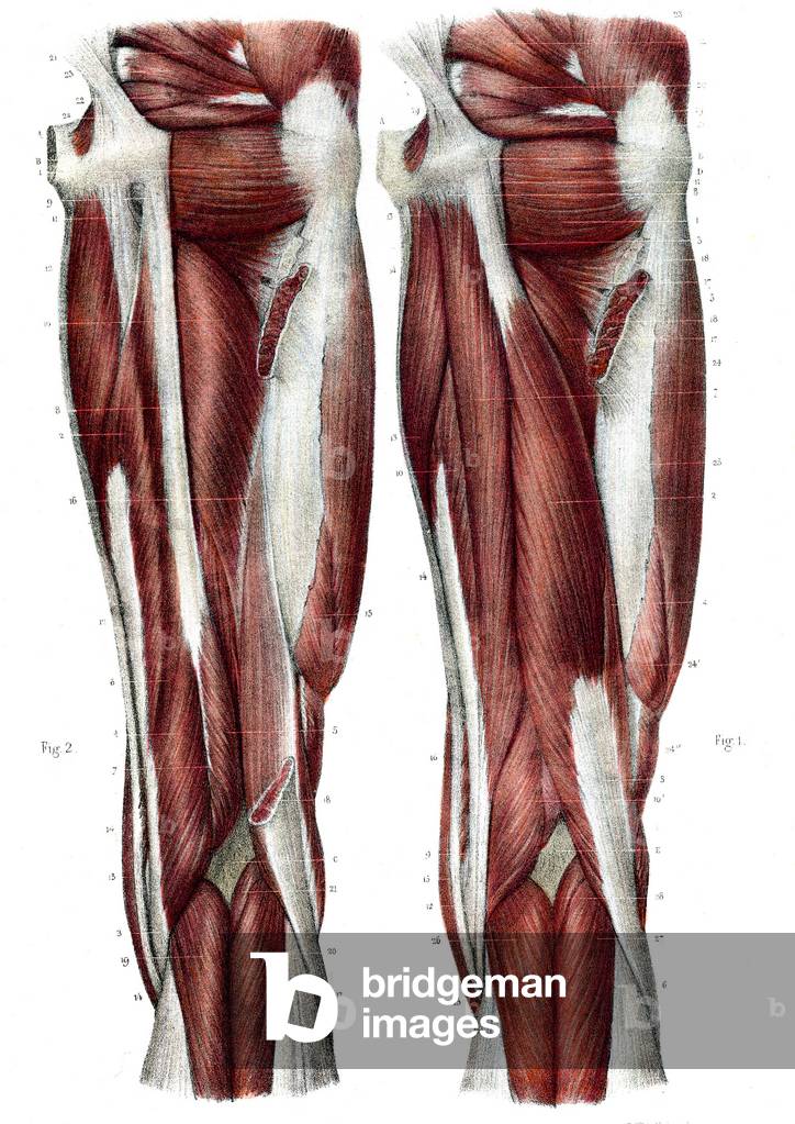 Leg muscles - 1866 illustration showing the structure of the muscles (brown) and tendons (white) of the rear of the upper leg - Region femoral posterieure - Fig 1: symphysis of the pubis, muscle carre femoral, Fig 2: symphysis of the pubis, sciatic tuberositis, 1866