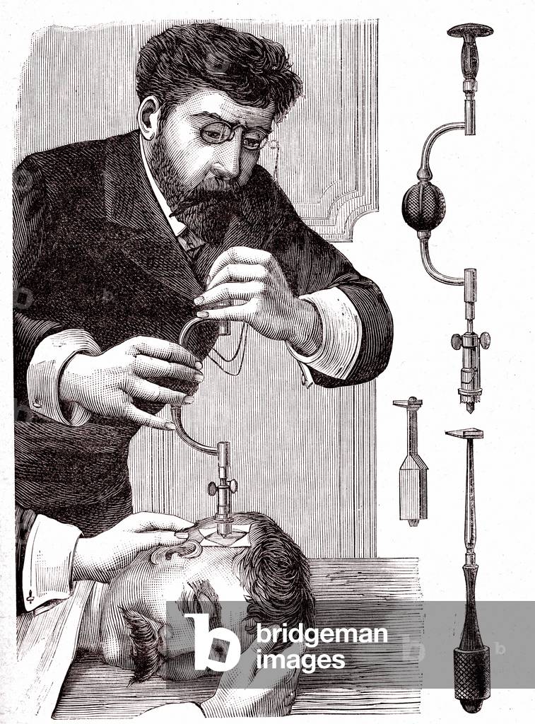 Drill bit and trepanation, 1887 (engraving)