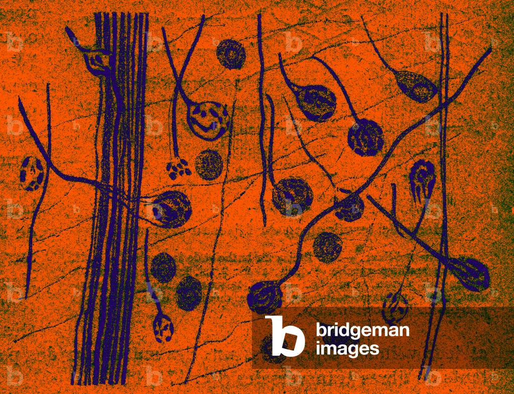 Isthmus of the encephalon, unipolar cells with Held chalices of the Trapezoi-dal core, 
