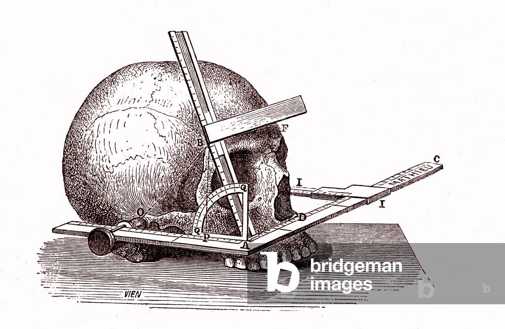 Cephalometry, Goniometer by Broca, 1867 (engraving)