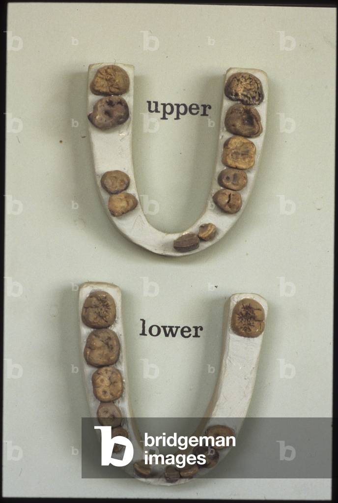 Hominid teeth, Olduvai Gorge (photo)
