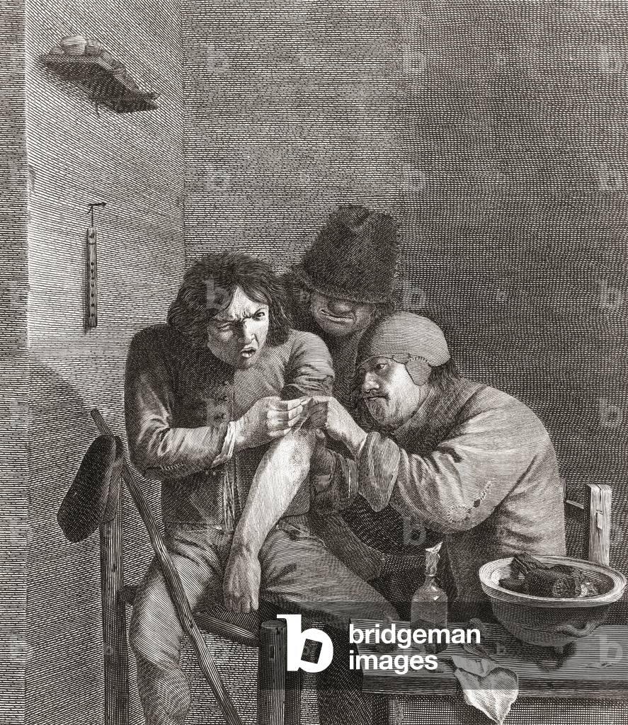Surgery in the 17th century
