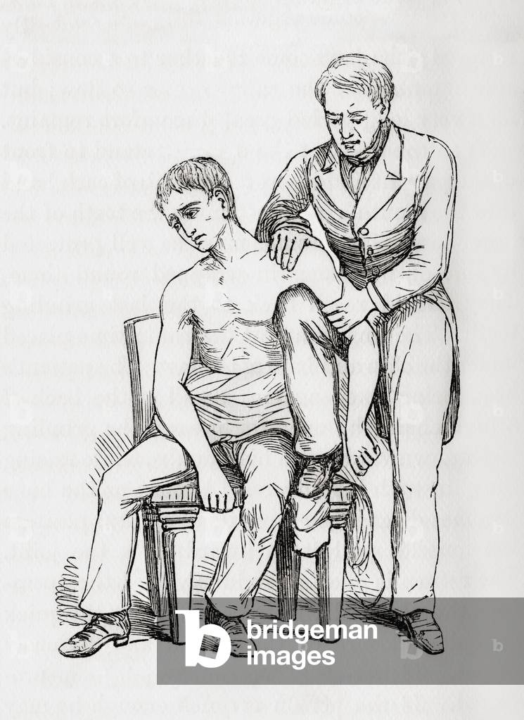 Method of reducing dislocation of the shoulder with knee in armpit,