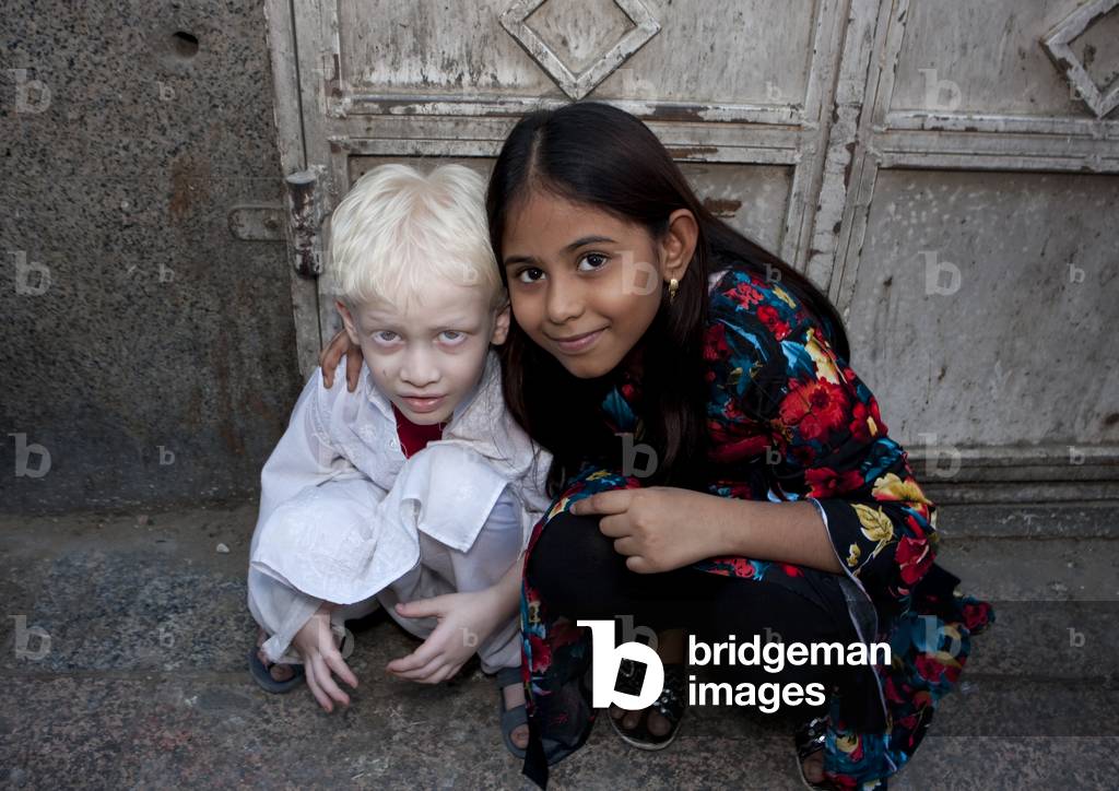 Albino Indian Boy in Jeddah, Saudi Arabia (photo)