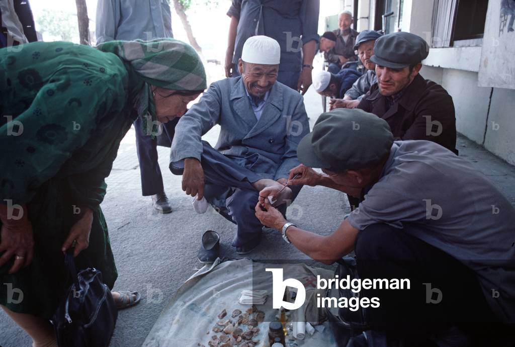 Man having corn treatment on his foot by Chinese medicine doctor in Urumqi Street, Xinjiang Province, China, 1985 (photo)