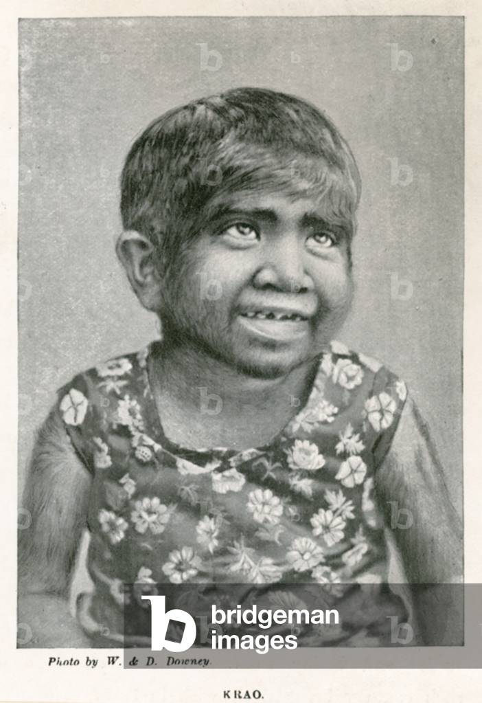 Krao, The Missing Link, exhibited at the Aquarium, Westminster, London, in 1887 (photo)