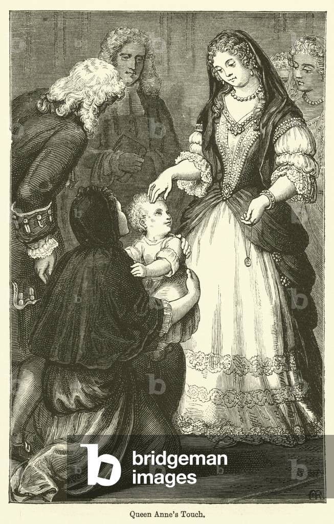 Queen Anne's Touch (engraving)