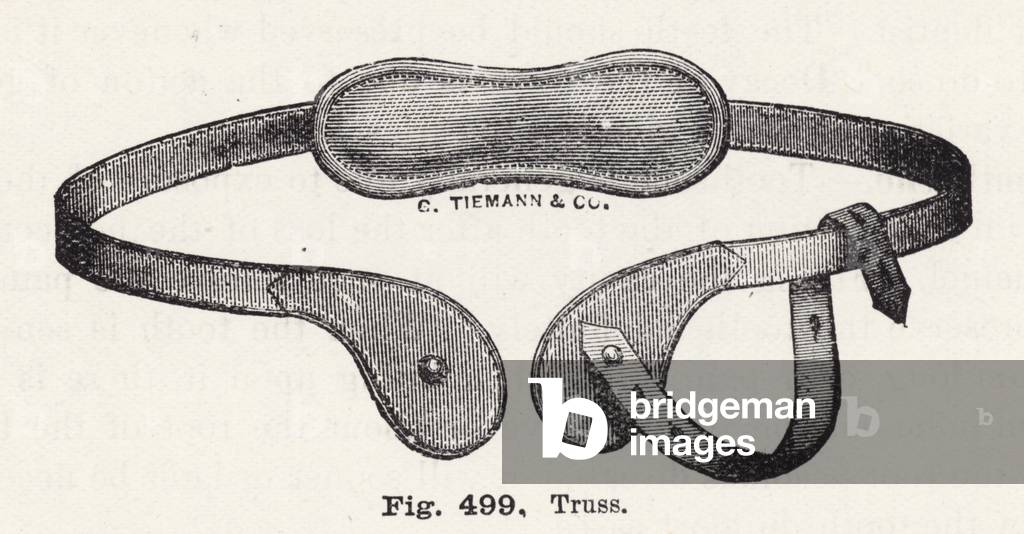 Truss (engraving)