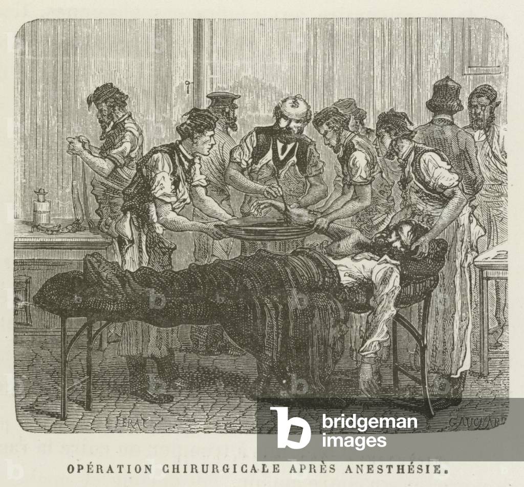 Operation Chirurgicale Apres Anesthesie (engraving)